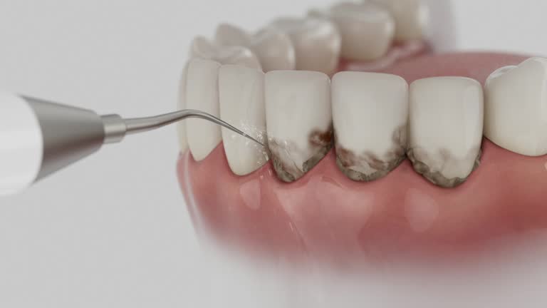 Trusted Wisdom Tooth Removal service in Homer, AK - Dentist Open Now